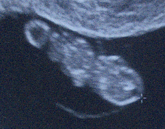 Ultrasound of the coming grandchild.